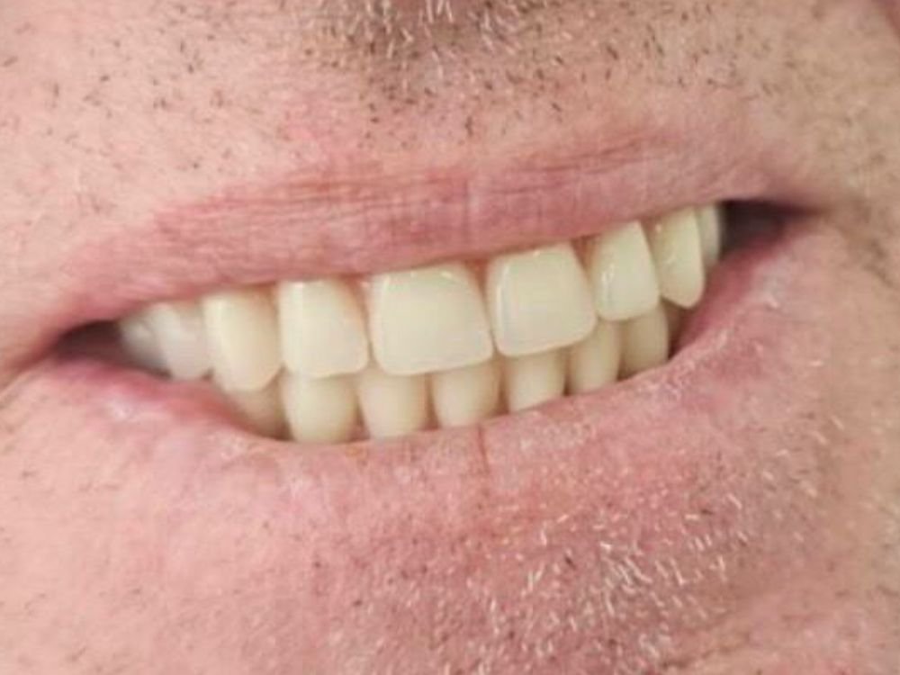 Dopo