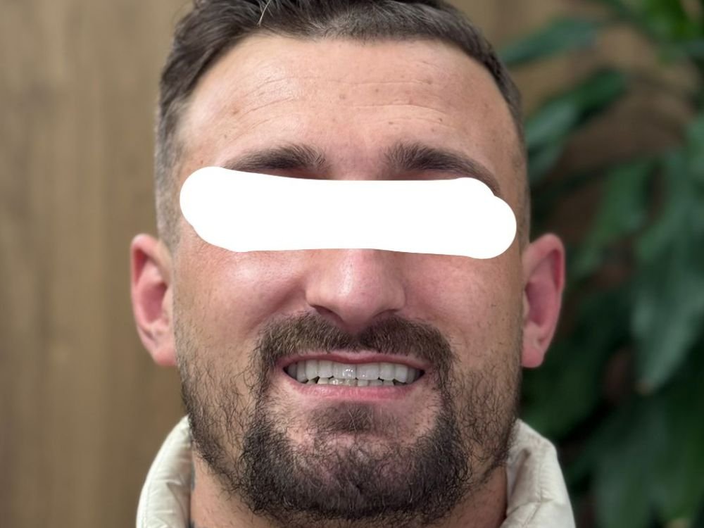 Dopo